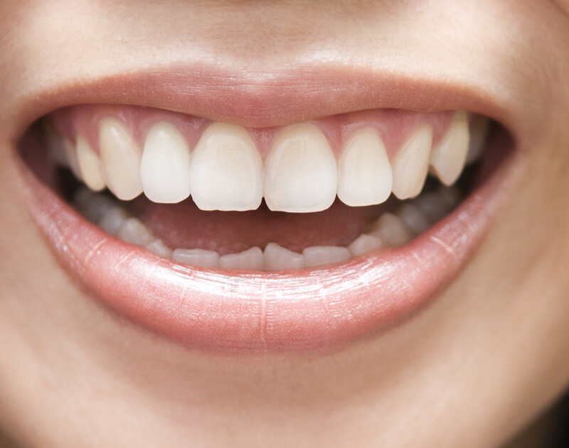 transformation-img-after-4