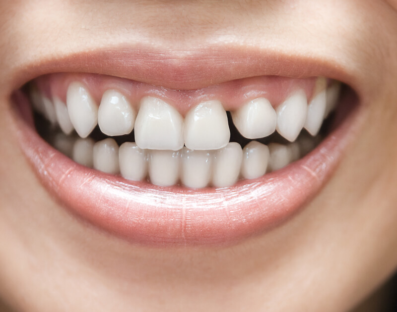 transformation-img-before-4