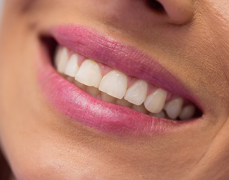 transformation-img-before-9